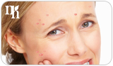 Acne breakout in middle-aged woman is an indicator of progesterone dominance