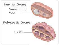natural hormones ovary causes